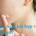 Azelaic Acid kết hợp với gì để trị mụn