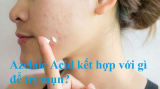 Azelaic Acid kết hợp với gì để trị mụn, bạn đã biết chưa?