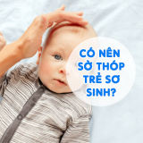 Có Nên Sờ Thóp Trẻ Sơ Sinh Không? 80% Các Mẹ Chưa Biết?