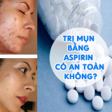 Sự Thật: Trị Mụn Bằng Aspirin Có An Toàn Không?