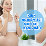 Kinh Nghiệm Trị Mụn Khi Mang Bầu Dành Cho Chị Em