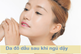 Da Đổ Dầu Sau Khi Ngủ Dậy- Bật Mí Cách Xử Lí