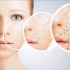 Mặt nạ cấp ẩm cho da khô nhạy cảm, bạn đã biết chưa?