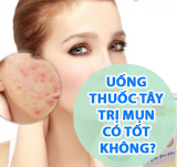 【HOT】Thật Hư: Uống Thuốc Tây Trị Mụn Có Tốt Không?